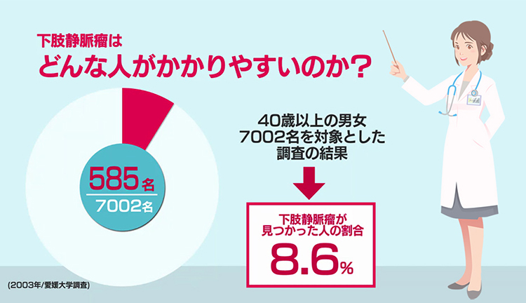 下肢静脈瘤はどんな人がかかりやすいのか？