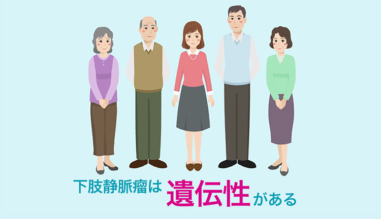 下肢静脈瘤は遺伝性がある