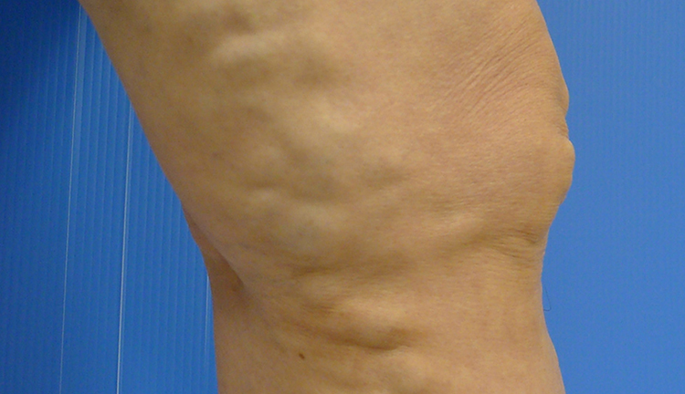 平均費用はいくらですか?